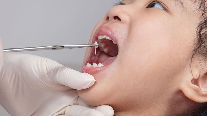 牙龈出血不可小觑 或是糖尿病信号