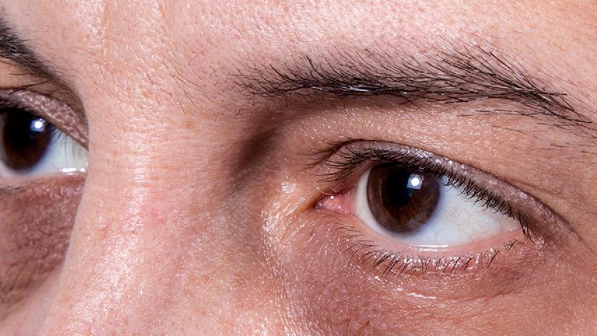 眼睑知健康：眼睑浮肿警惕肾脏疾病