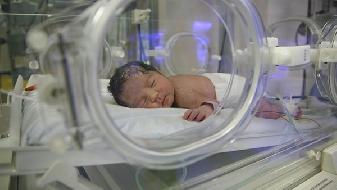 什么样的新生儿得溶血病 为什么新生儿会患溶血症
