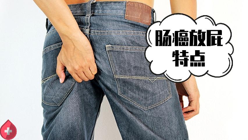 晚期結(jié)腸癌能活多久？治療結(jié)腸癌主要方法是手術(shù)嗎