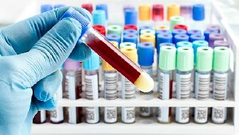 武汉生物和北京科兴新冠疫苗能混打吗 新冠加强针能混打吗