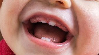 怎样正确防治秋季嘴唇干裂 防治秋季嘴唇干裂方法有哪些