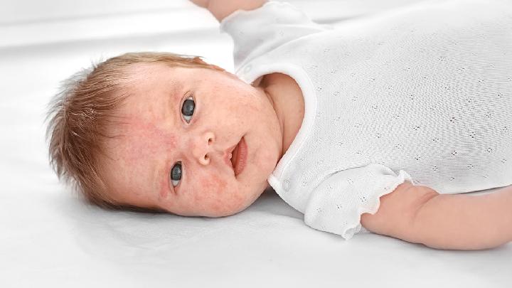 新生儿一直打喷嚏正常吗 新生儿打喷嚏是什么原因