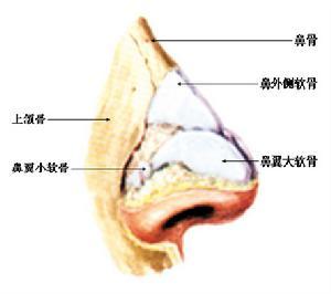 鼻中隔穿孔