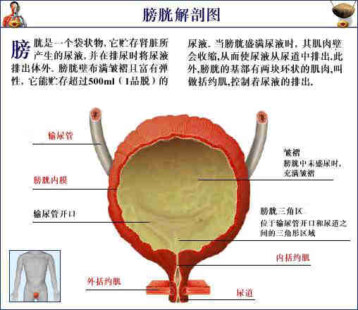 膀胱膨隆图片图片