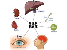 肝豆状核变性