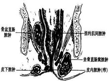 肛门直肠脓肿