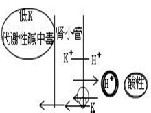 代谢性碱中毒