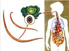 蛔虫病