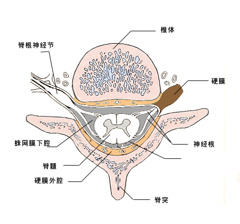 脊髓蛛网膜炎