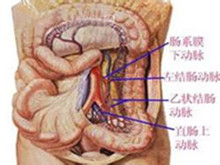 结肠血管扩张症