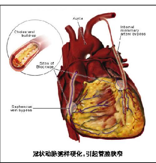 心绞痛挂什么科图片