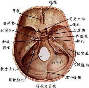 脑膜瘤位置图解图片