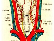 卵巢甲状腺肿