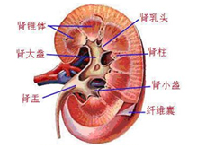 肾错构瘤