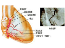 心血管疾病