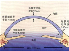 原发性开角型青光眼