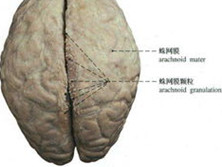 蛛网膜炎