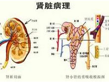 隐匿性肾炎