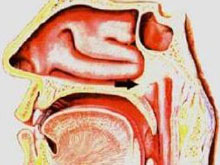 先天性后鼻孔闭锁