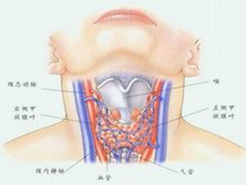 亚急性甲状腺炎