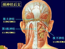 枕神经痛