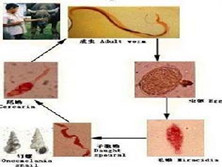 埃及血吸虫病