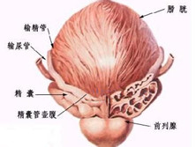 ADH分泌过多综合征