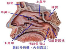 鼻旁窦支气管综合征