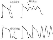 长Q-T间期综合征