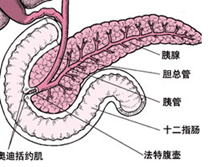 胆源性慢性胰腺炎