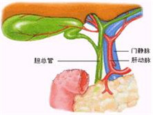 胆道运动功能障碍综合征