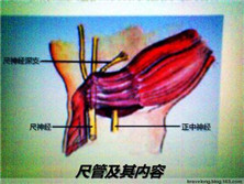 尺管综合征