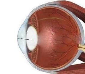 习惯性下巴脱臼,眼球震颤,睫状充血,色素脱失,足底脱