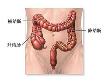 肠阿米巴病