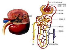 高钙血症肾病