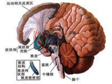 进行性核上性麻痹