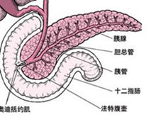 急性胆源性胰腺炎