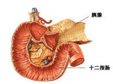 急性出血坏死型胰腺炎