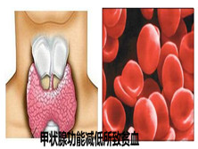 甲状腺功能减低所致贫血