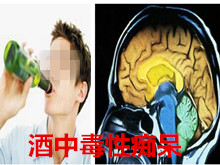 酒精中毒性痴呆