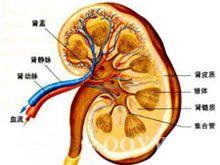 老年原发性恶性高血压引起的恶性小动脉肾