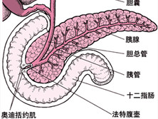 老年急性胰腺炎