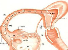 慢性输卵管卵巢炎