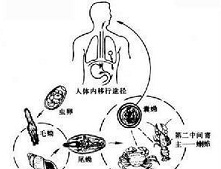 腦肺吸蟲病
