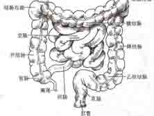 缺血性结肠炎