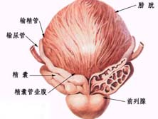 前列腺钙化