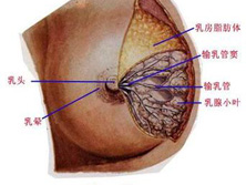 乳管内乳头状瘤早期症状表现