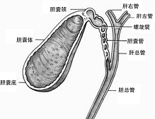 濃縮膽汁綜合征