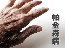 帕金森